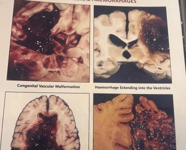 Educational Visit to Kamineni Institute of Medical Science and Research, LB Nagar (5)