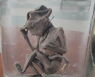 Educational Visit to Kamineni Institute of Medical Science and Research, LB Nagar (9)